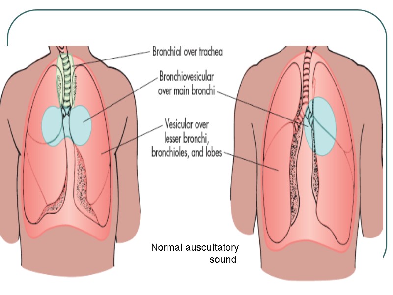 Normal auscultatory sound